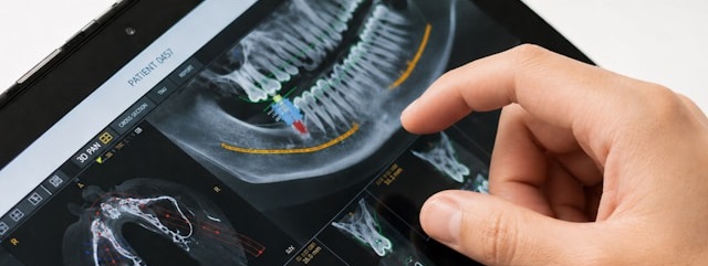 Имплантация зуба под ключ в Clinica MED в Москве